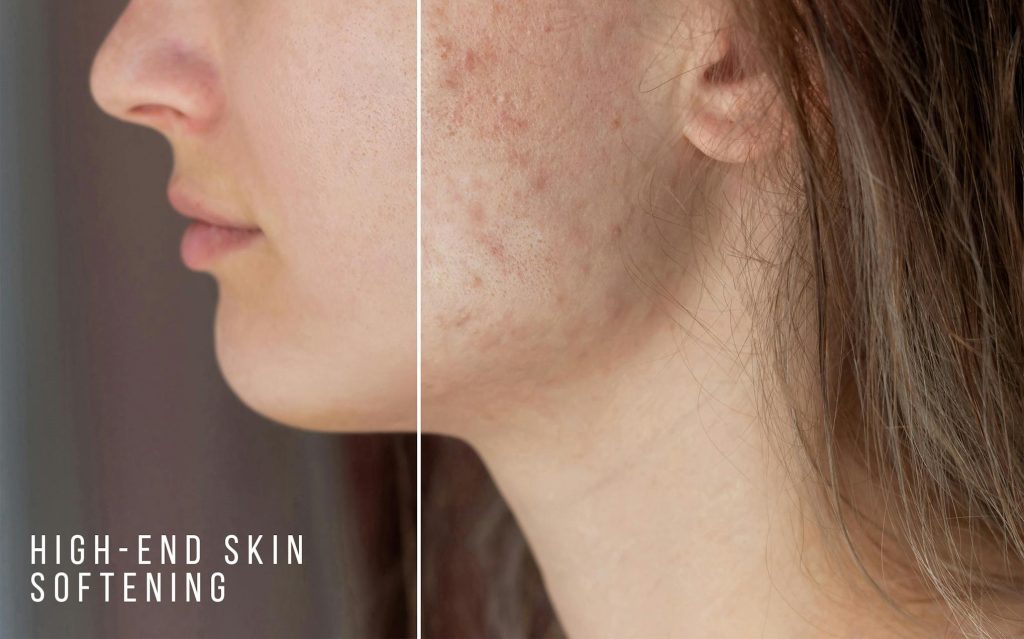 fashion-photo-editing-skin-retouching